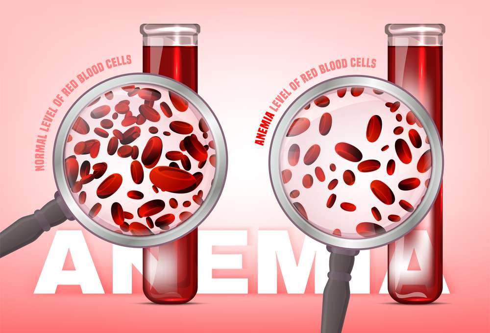 anemia.jpg